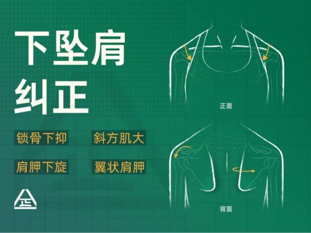 【众筹】根正派一介粗人下坠肩纠正视频课程